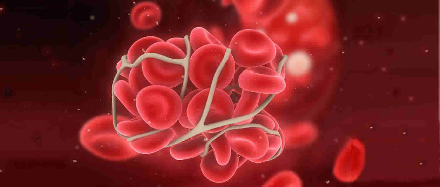 Thrombophilia – Thrombocytopenia What is it?