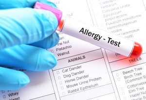 τεστ αλλεργιας