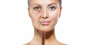 skin aging - photoaging
